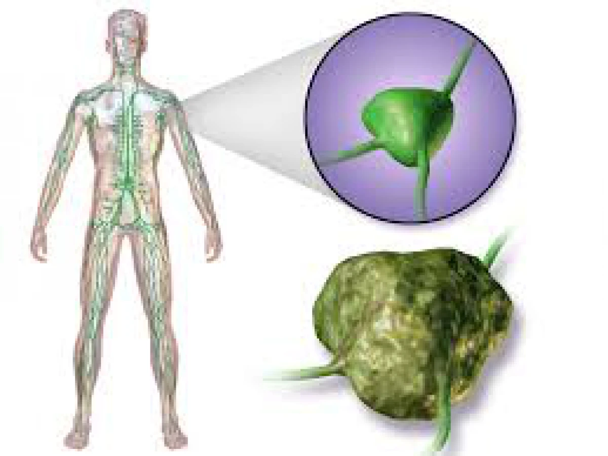 Overview about Lymphoma